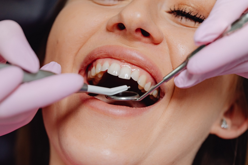 Dental Implants in Guildford: A Comprehensive Guide