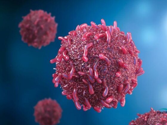 CAR-T Cell Treatment in Turkey: A Revolutionary Approach