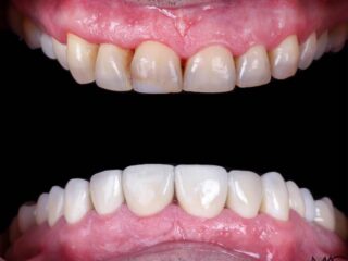 Mejora tu sonrisa con soluciones dentales modernas