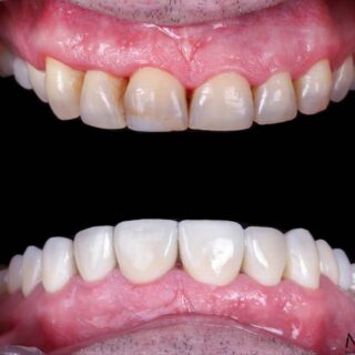 Mejora tu sonrisa con soluciones dentales modernas