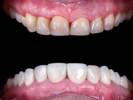 Mejora tu sonrisa con soluciones dentales modernas